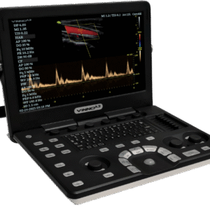 Ultrasonido VINNO A3 – Estación de diagnóstico portátil y versátil