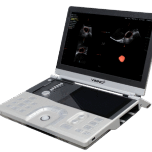 Ultrasonido VINNO 5 – Portátil de Alto Rendimiento con Imagen Premium